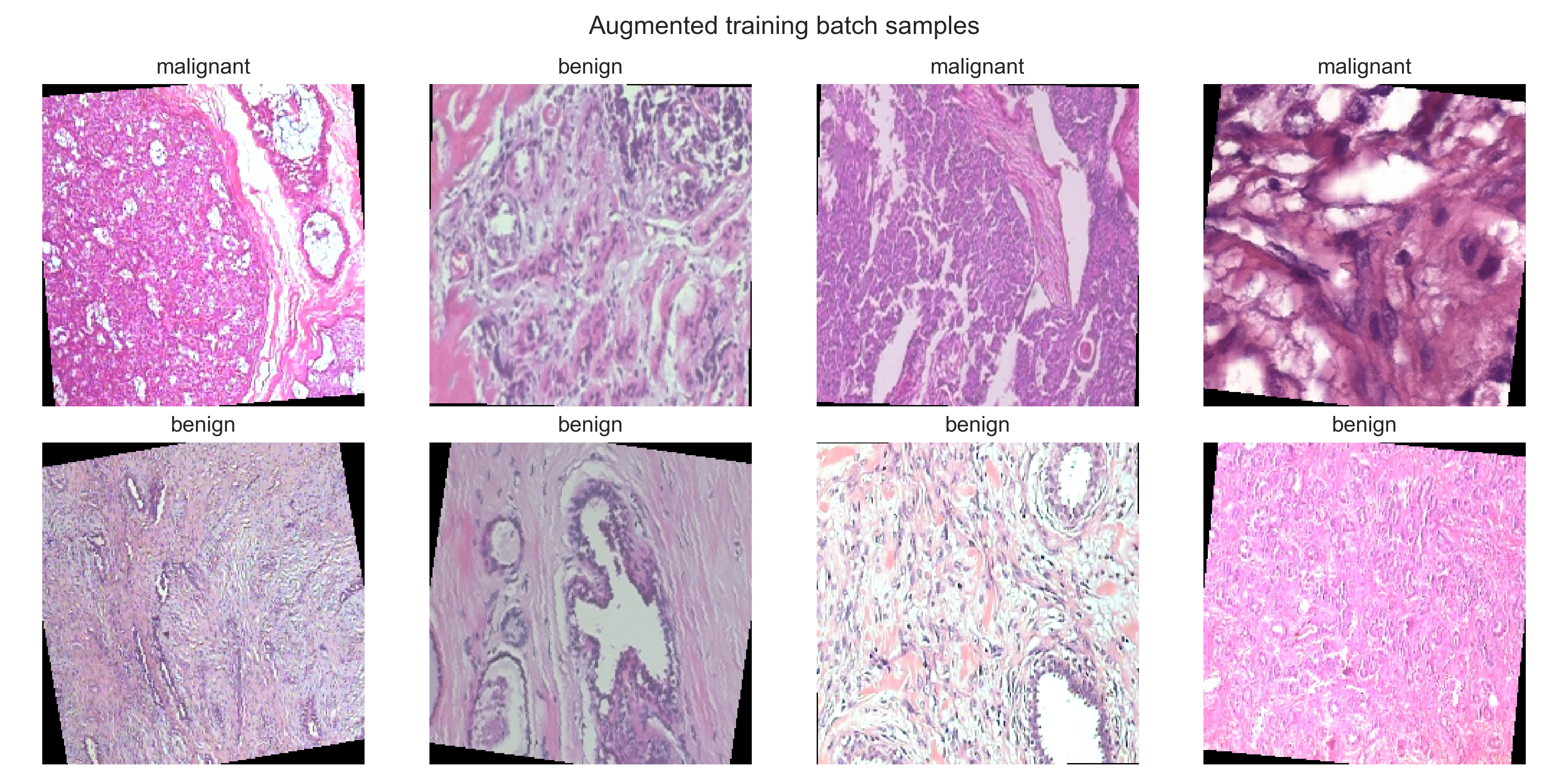 Examples from the final augmentation and preprocessing pipeline.
